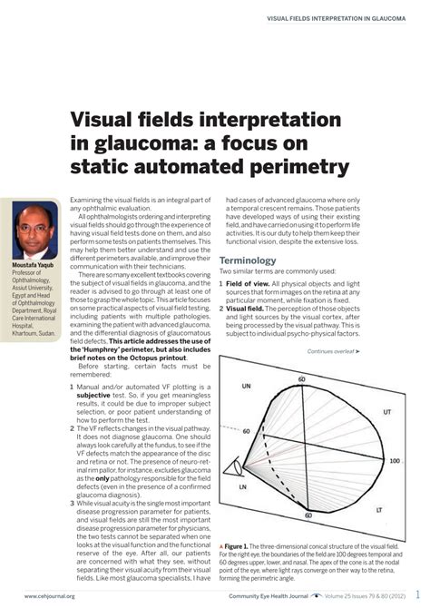 automated perimetry test results interpretation|Visual fields interpretation in glaucoma: a focus on static .